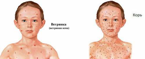 В большинстве случаев при соблюдении назначений лечащего доктора осложнений не бывает