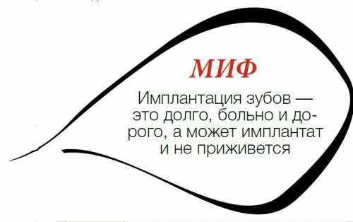 Преимущества имплантации зубов - мифы и реальность