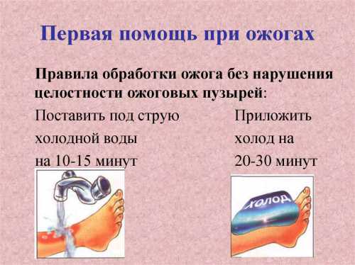 Первая помощь при ожоге