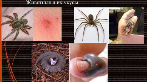 Чтобы обезопасить пострадавшего от осложнений, оказывая помощь при укусах насекомых народными методами, предлагаем ознакомиться с рецептами приготовления целебных составов и правилами их использования