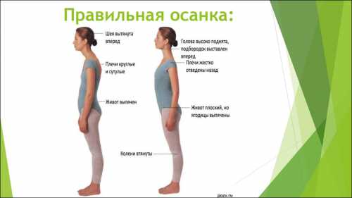 Правильная осанка