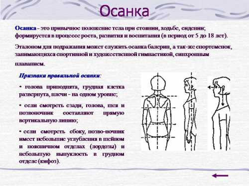 Нарушения осанки Как исправить